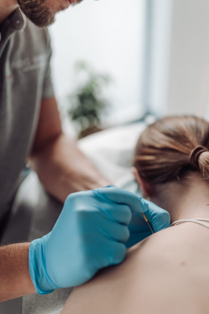 igłoterapia Kraków